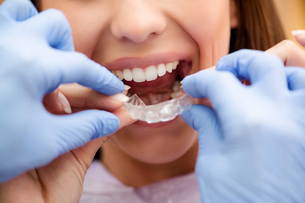 Ortodonzia Invisibile – Studi dentistici Curreli – dentista Cagliari Selargius Vallermosa